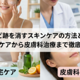 ニキビ跡を消すスキンケアの方法とは？自宅ケアから皮膚科治療まで徹底解説