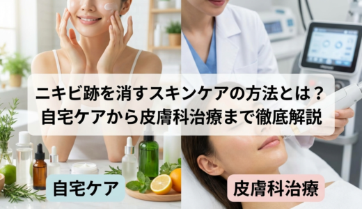 ニキビ跡を消すスキンケアの方法とは？自宅ケアから皮膚科治療まで徹底解説